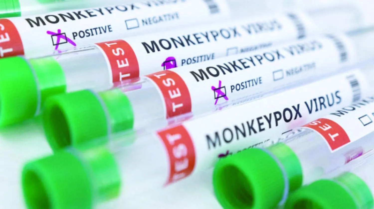 أنابيب اختبار لـ«جدري القردة» (رويترز)