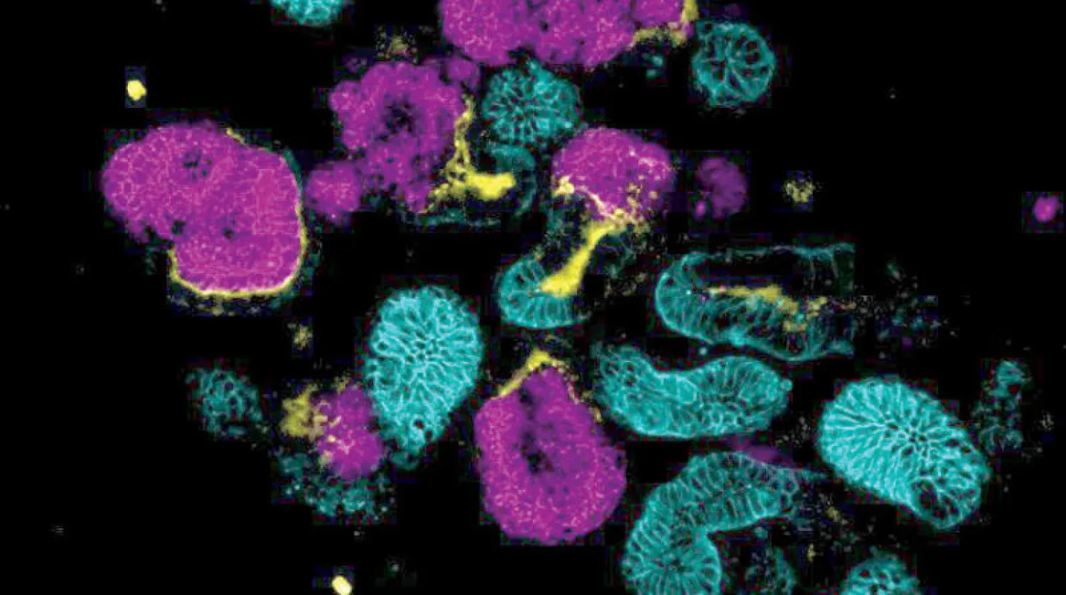 صورة مجهرية لعضيات الكلى المنتجة معملياً (ساينتفيك ريبورتيز)