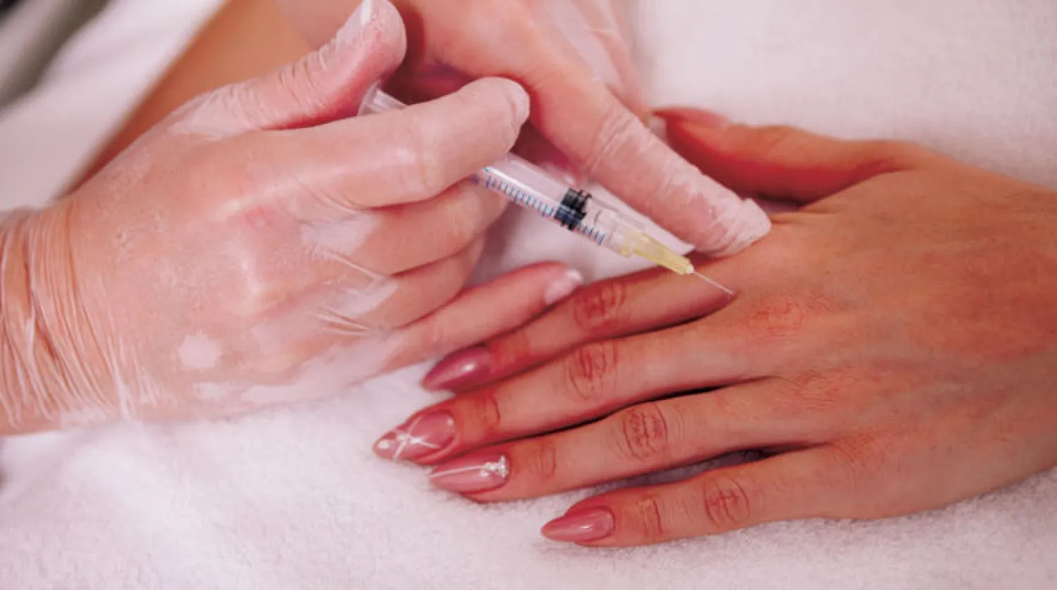 حقن اليد بواسطة ثقب واحد يتم تمرير الإبرة من خلاله تحت الجلد