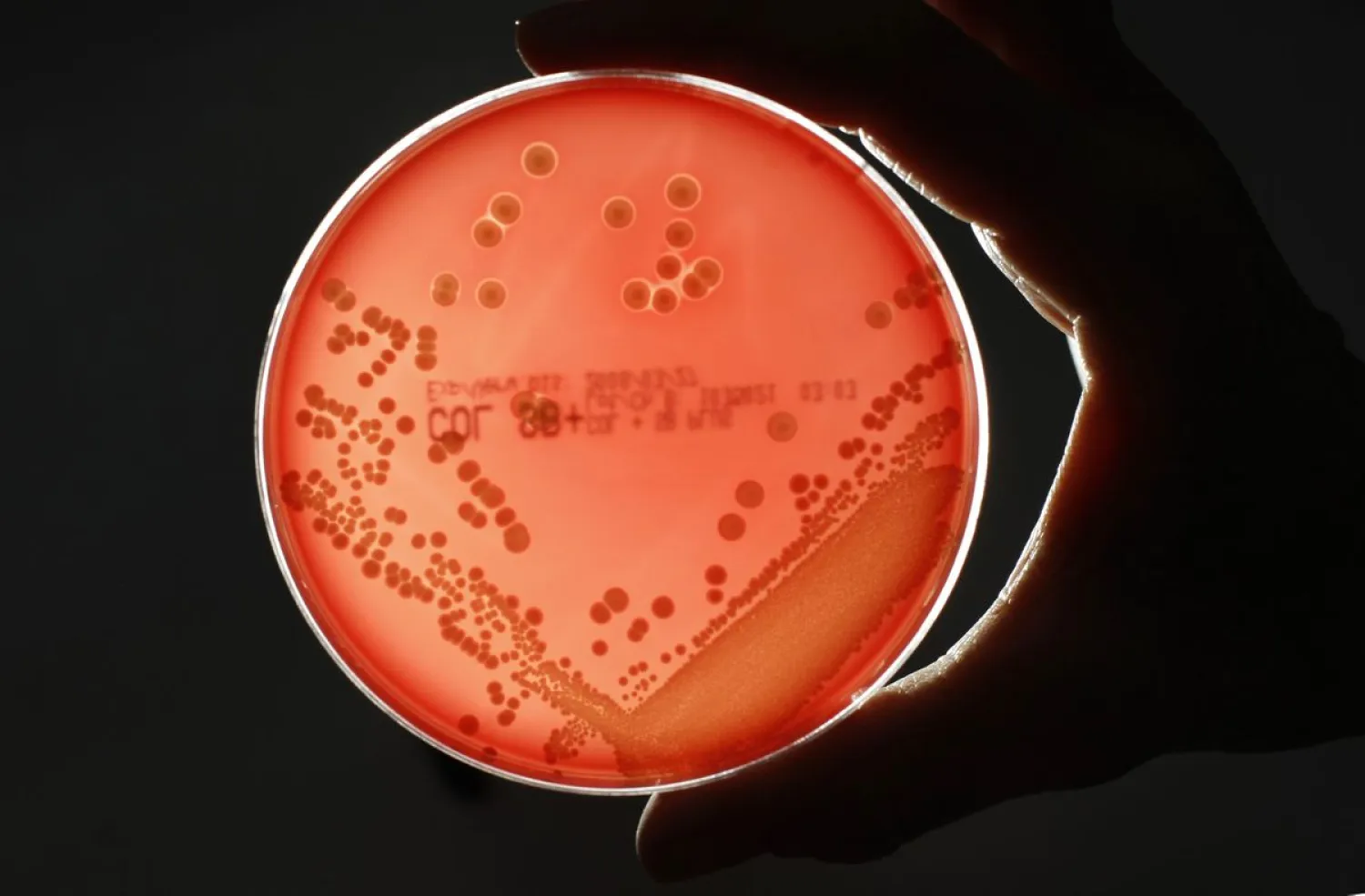 MRSA (Methicillin-resistant Staphylococcus aureus) bacteria
strain is seen in a petri dish containing agar jelly for bacterial
culture in a microbiological laboratory in Berlin March 1, 2008.
REUTERS/Fabrizio Bensch