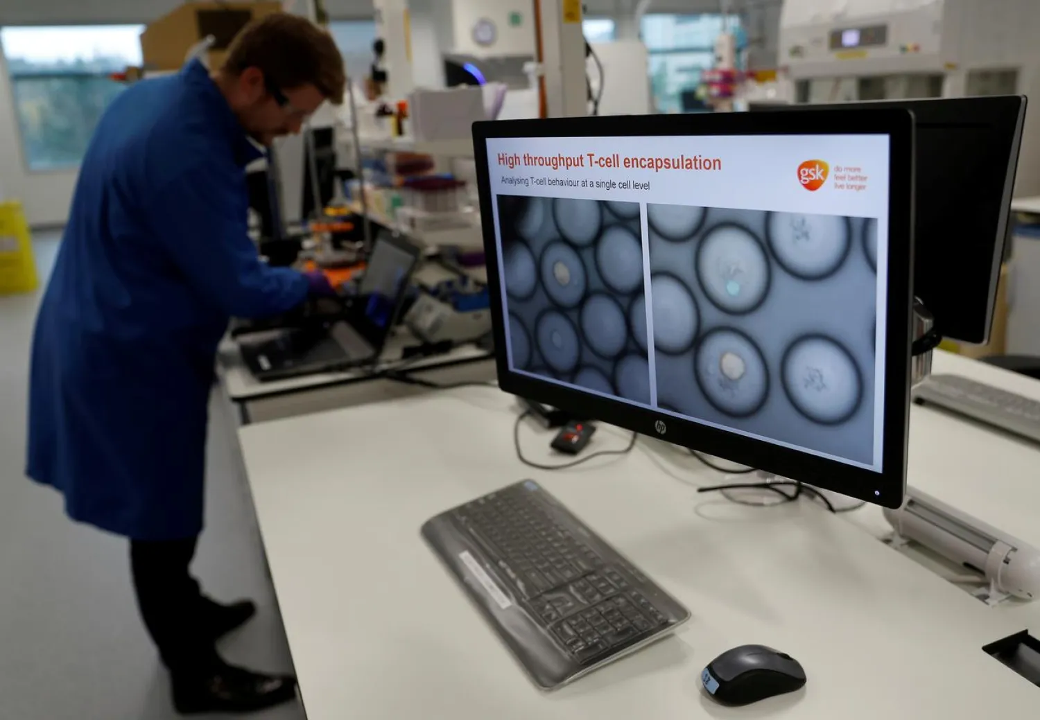 A scientist studies cancer cells inside white blood cells through a microscope at the GlaxoSmithKline (GSK) research center in Stevenage, Britain November 26, 2019. (Reuters)
