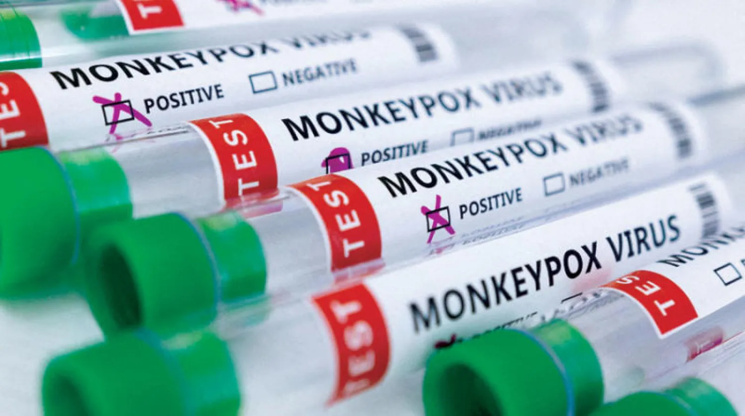 عينات من حالات مؤكدة للمصابين بفيروس جدري القردة في مختبر طبي مايو الماضي (رويترز)