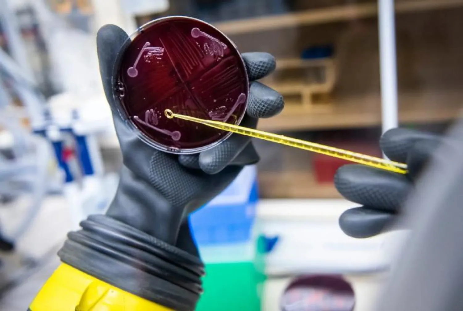 يمكن للميكروبيوم الصناعي الجديد أن يتصدى لمسببات الأمراض العدوانية (نيويورك تايمز)