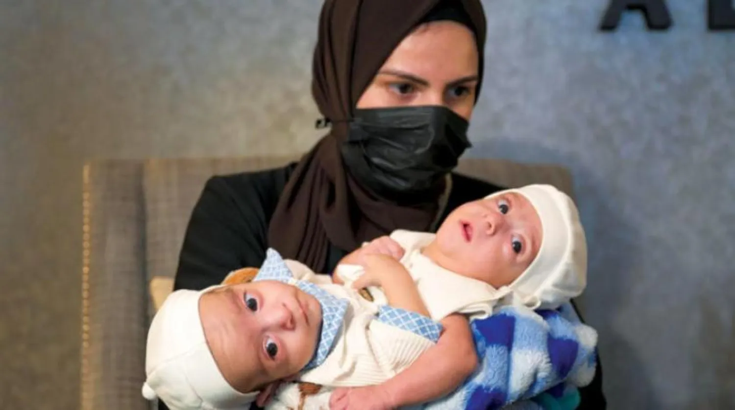 Iraqi Siamese twins Omar and Ali have arrived in Riyadh, accompanied by their parents. SPA