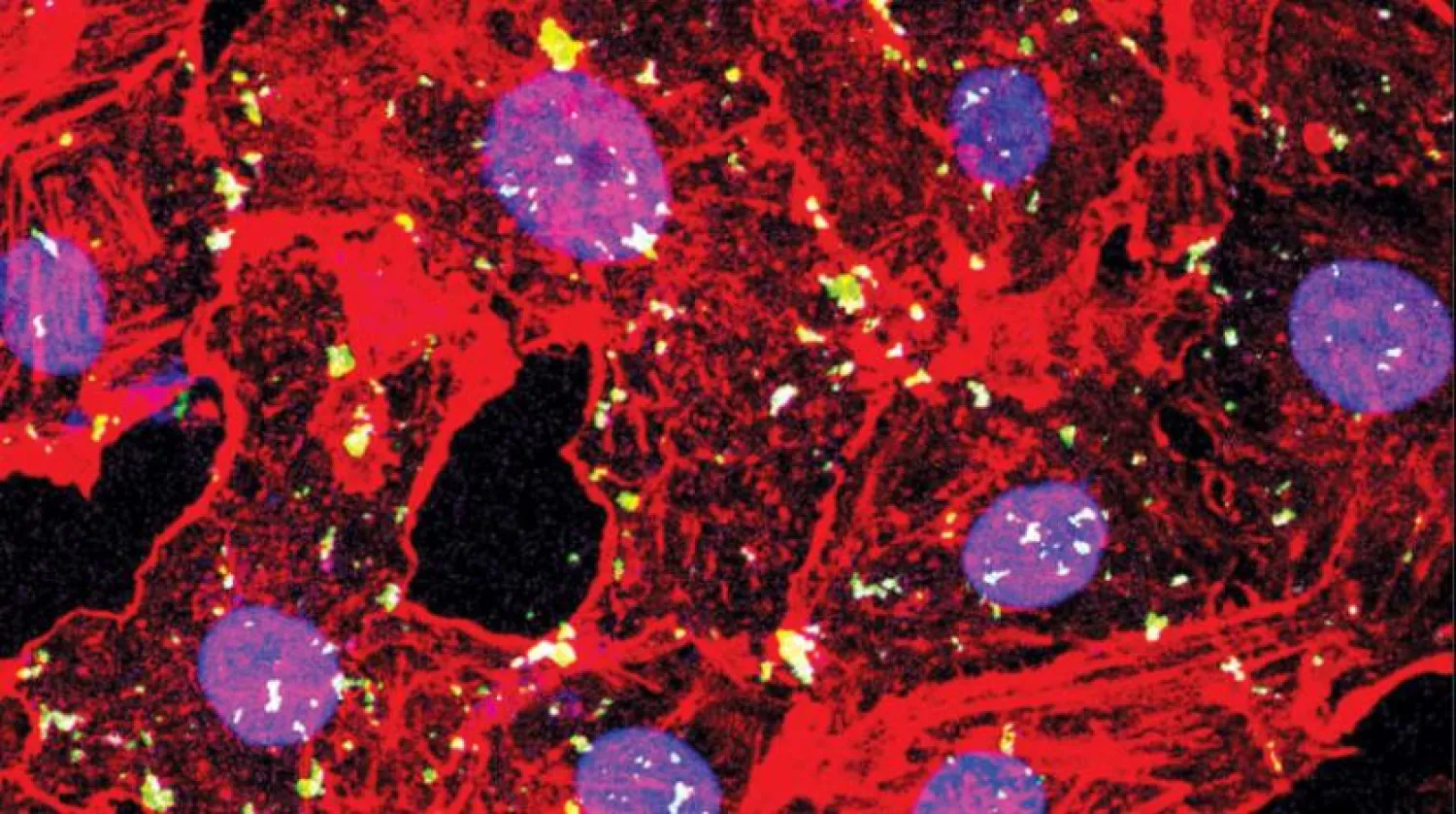 Kırmızı ile işaretlenmiş hücrelerde yeşil noktalar olarak virüs benzeri protein zarfı (Araştırma Ekibi)