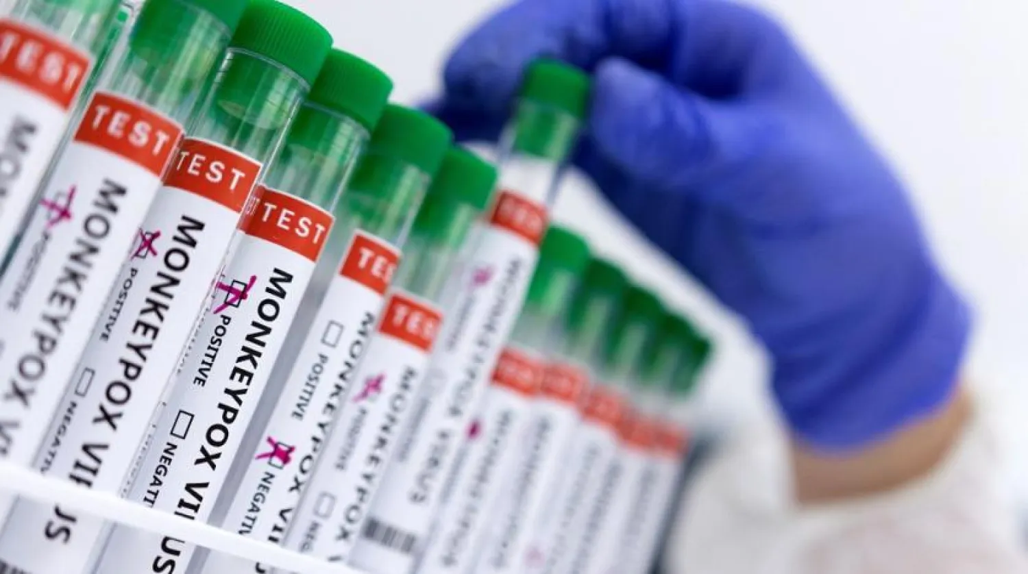 Test tubes labelled “Monkeypox virus positive and negative” are seen in this illustration taken May 23, 2022. (Reuters) 