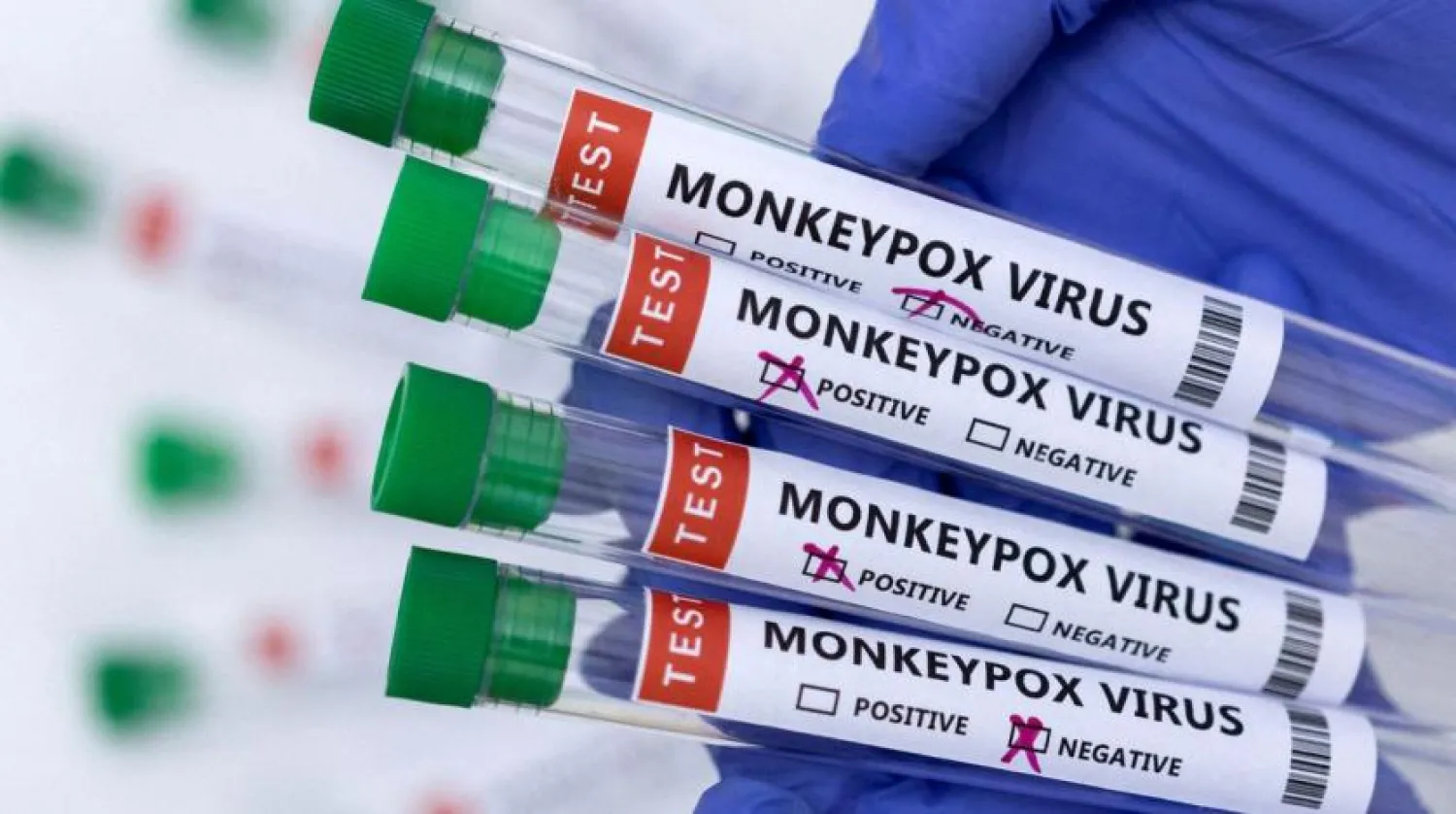Test tubes labelled "Monkeypox virus positive and negative" are seen in this illustration taken May 23, 2022. REUTERS/Dado Ruvic/Illustration
