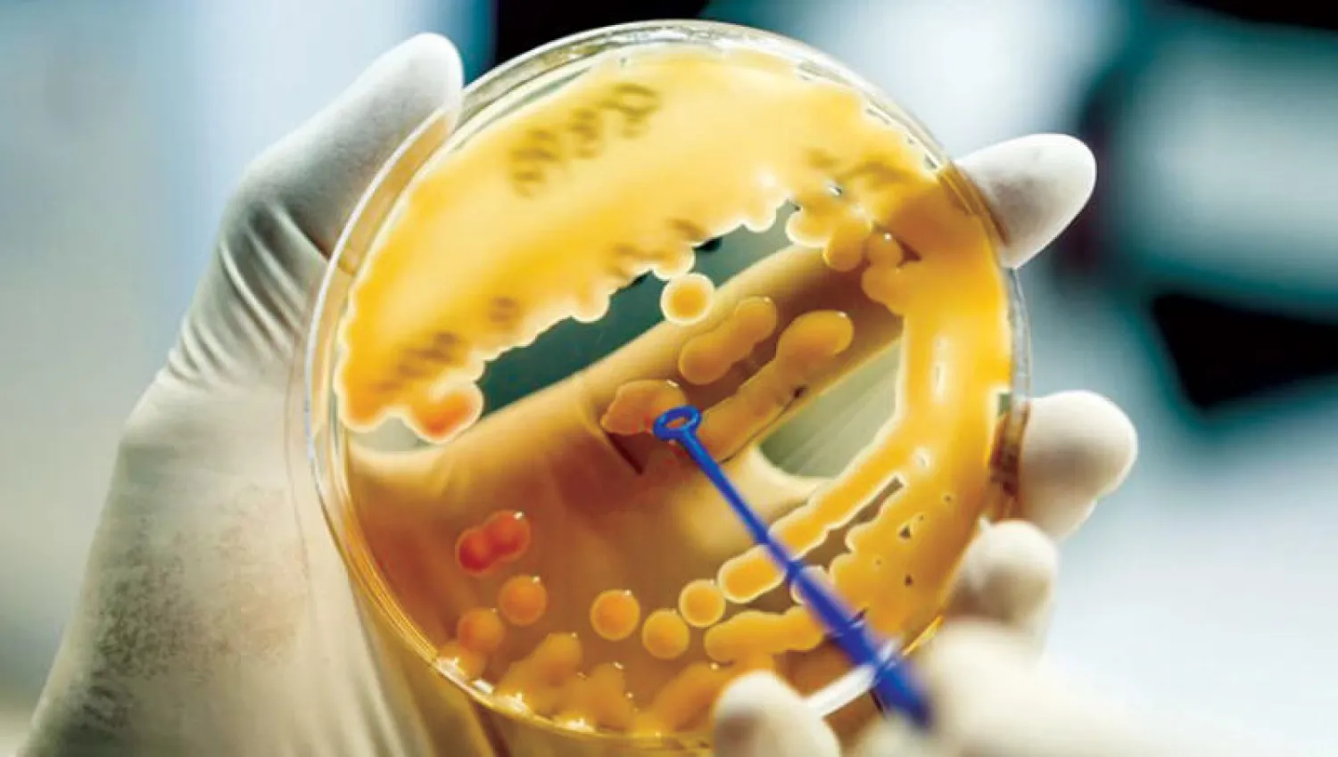 بكتيريا الكلبسيلة الرئوية حيرت العلماء لعقود