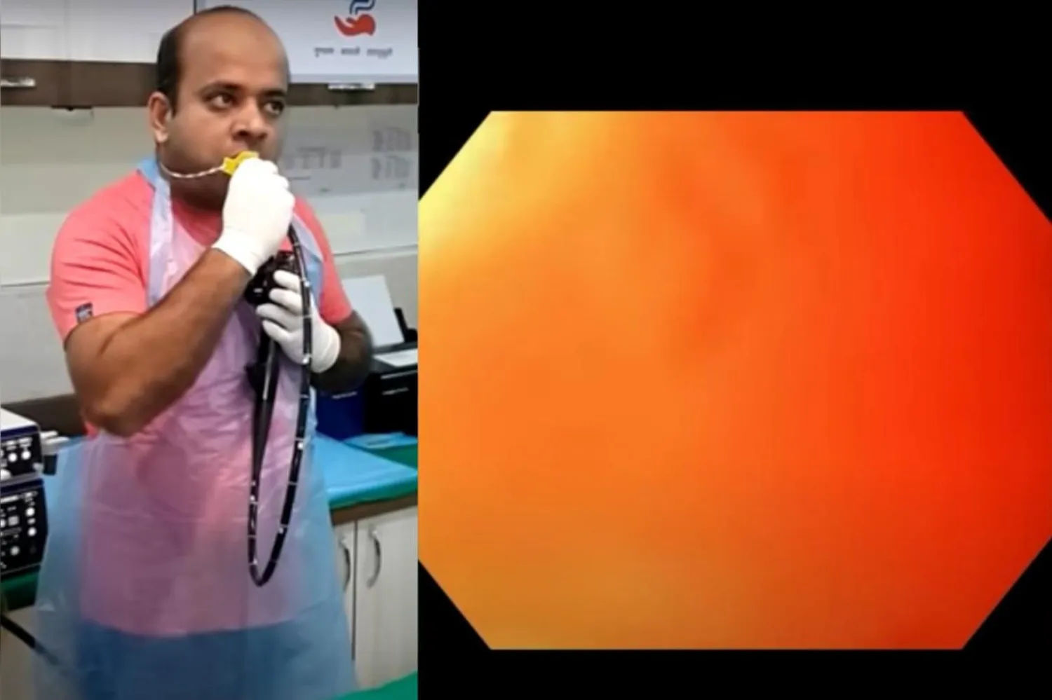 Doktor bu işlemle endoskopi cihazı üzerindeki manevralarını geliştirmek istedi (Galaxy Hospital / YouTube)

