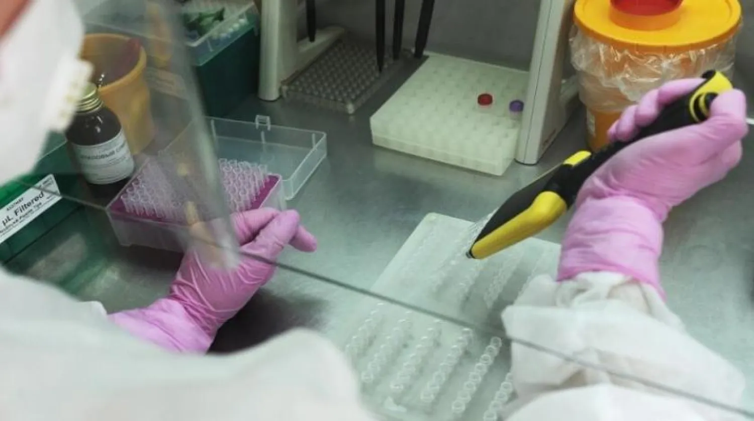 Rus doktorlar hasarlı organları tedavi etmek ve büyütmek için bir yol geliştirdi