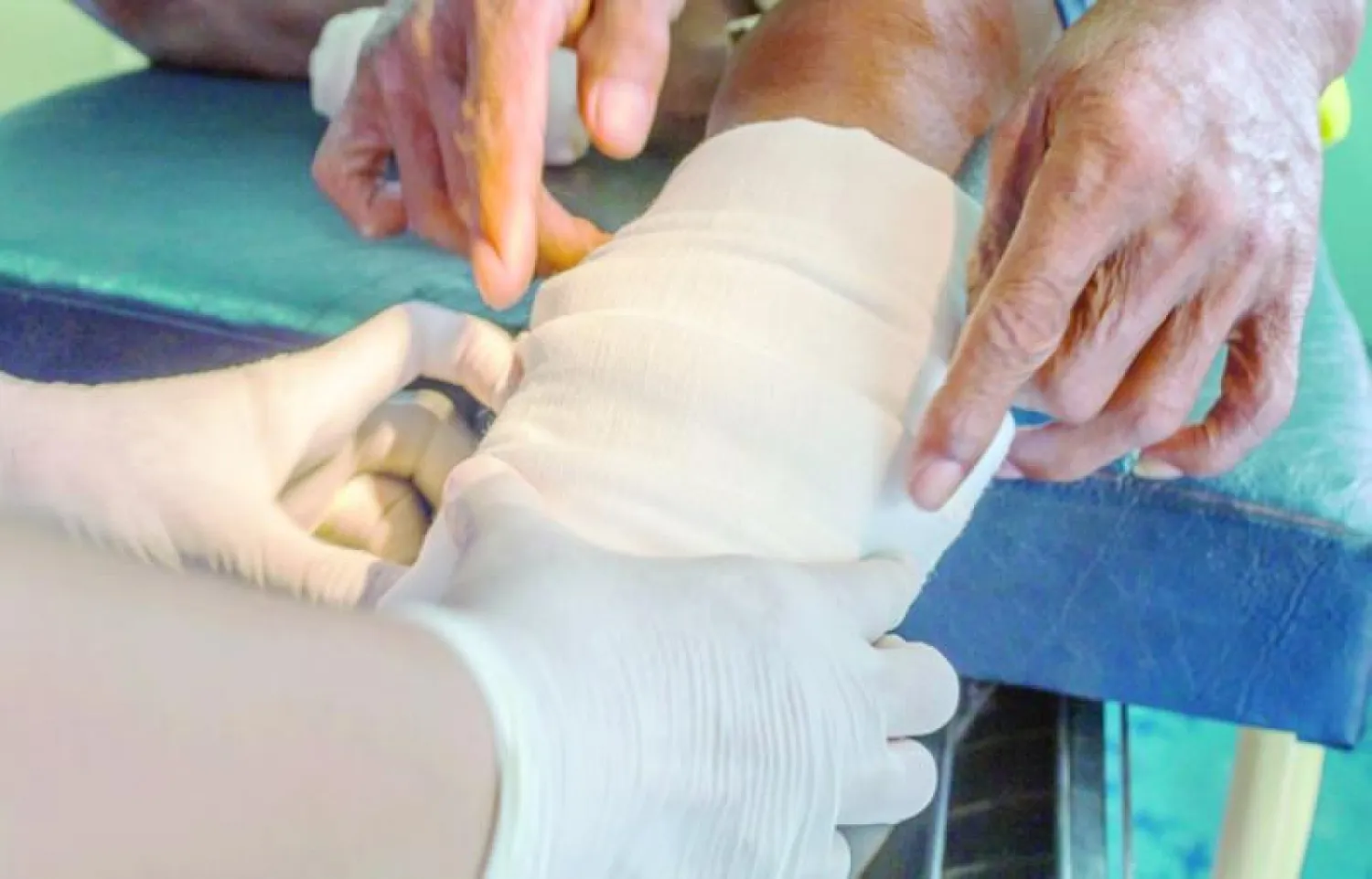 البوليمر يستخدم لضمادات الجروح (جامعة نوتنغهام)