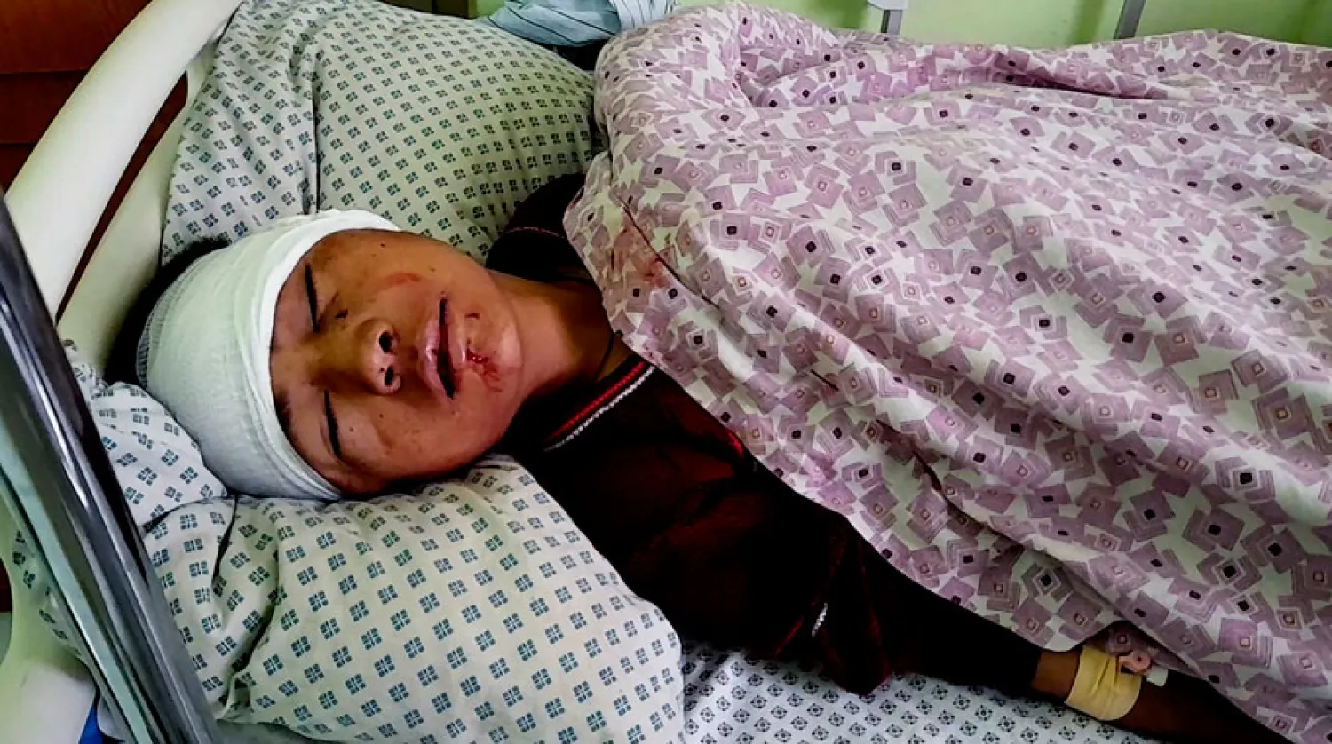 صبي يتلقى العلاج في مستشفى بعد إصابته بالإنفجار في المدرسة الدينية، أمس (أ. ب)