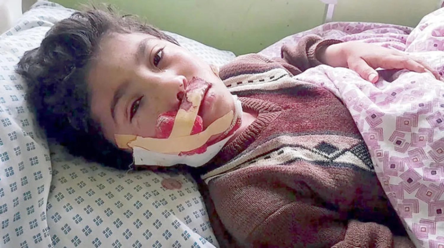 طفل جريح يتلقى العلاج في مستشفى بعد انفجار قاتل في مدرسة دينية في أيبك عاصمة مقاطعة سامانجان في شمال أفغانستان (أ.ب)