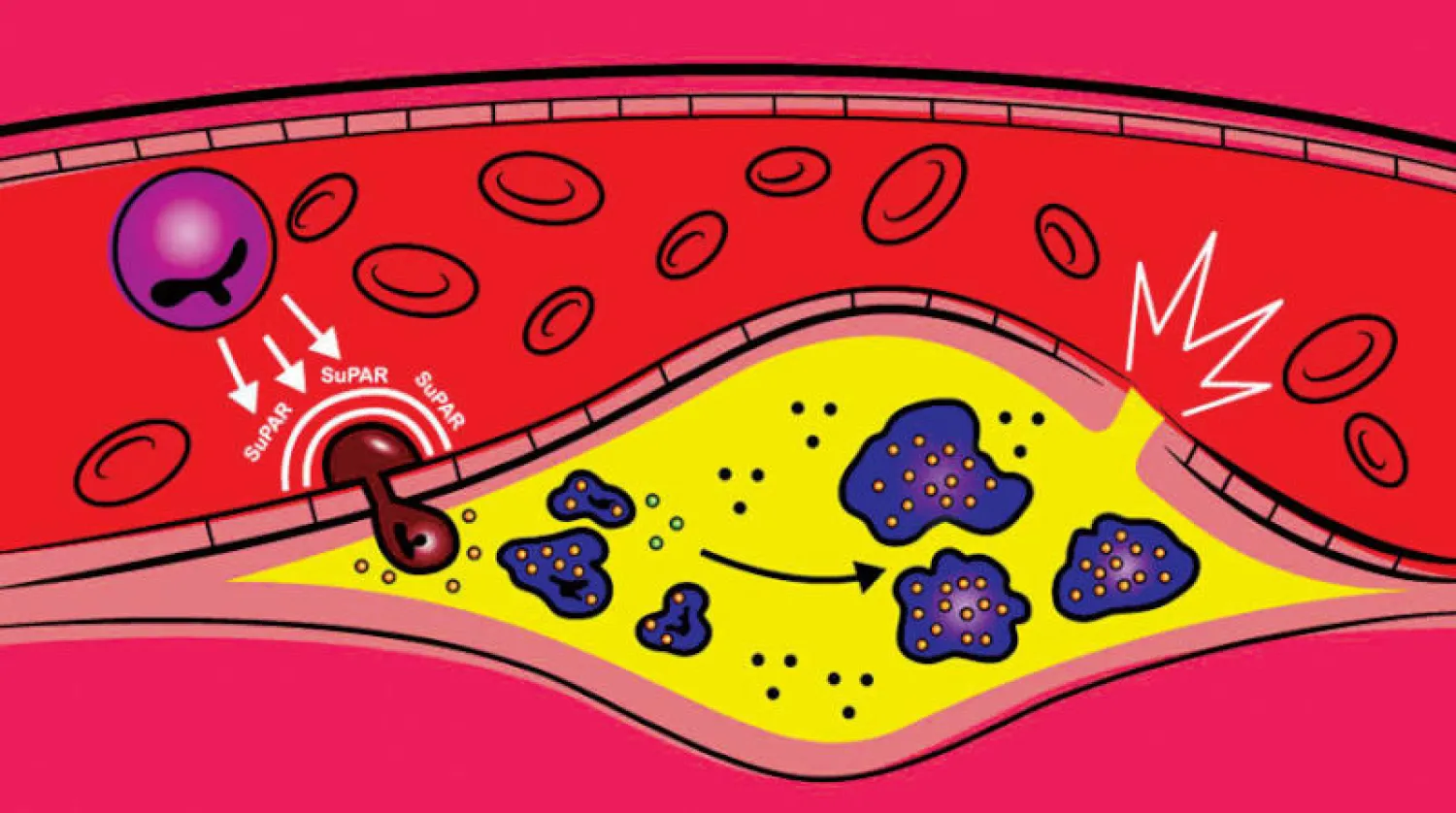 تصور فني للدور الذي يلعبه البروتين «suPAR» (جامعة ميشيغان)
