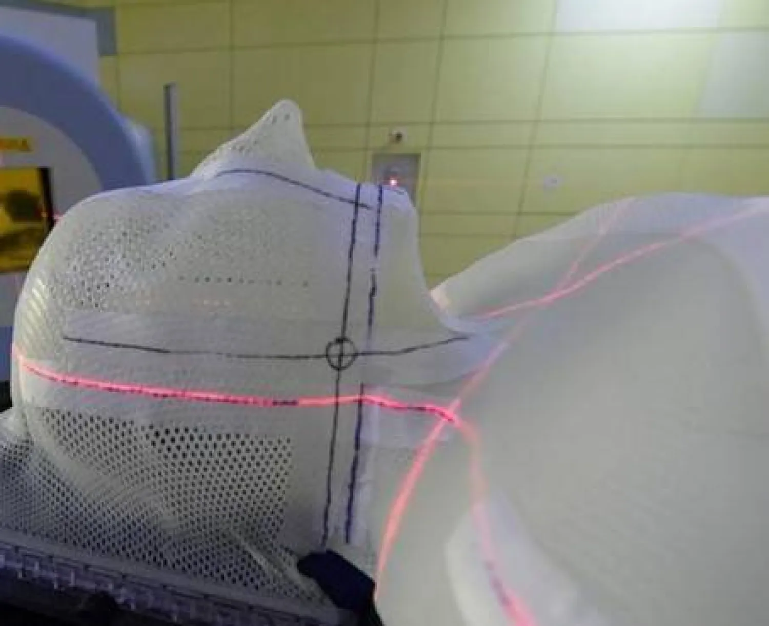 روسيا تختبر جهازا للموجات فوق الصوتية يقتل الأورام