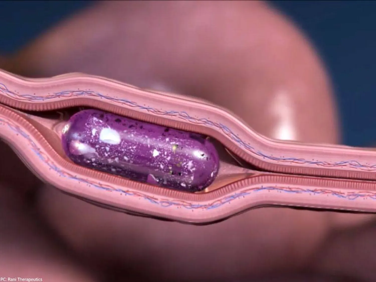 حبوب روبوتية تحقن الدواء في الأمعاء (شركة «راني ثيرابيوتكس»)