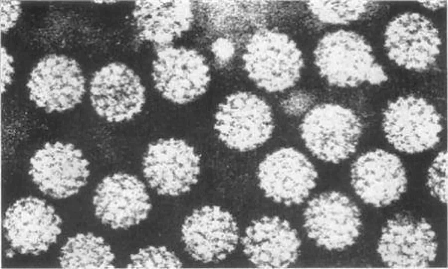 طبيبة: الاختصاصي فقط هو من يحدد طبيعة الورم الحليمي