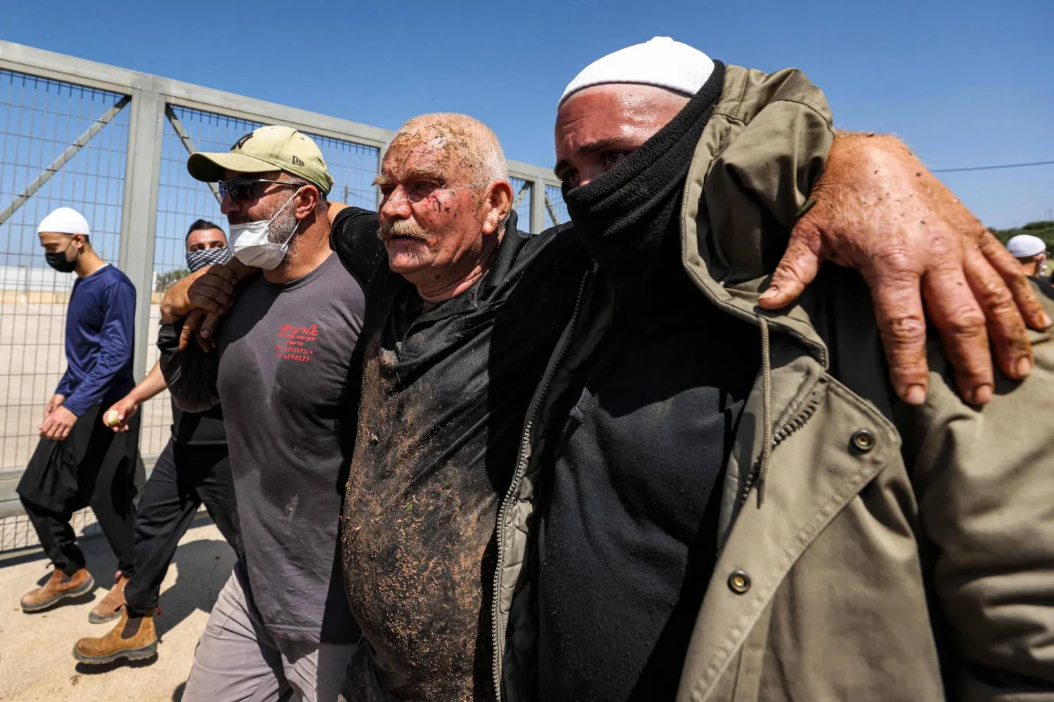 جريح درزي في مواجهات ضد قوات الأمن الإسرائيلية في مجدل شمس بهضبة الجولان يوم الأربعاء الماضي (أ.ف.ب)