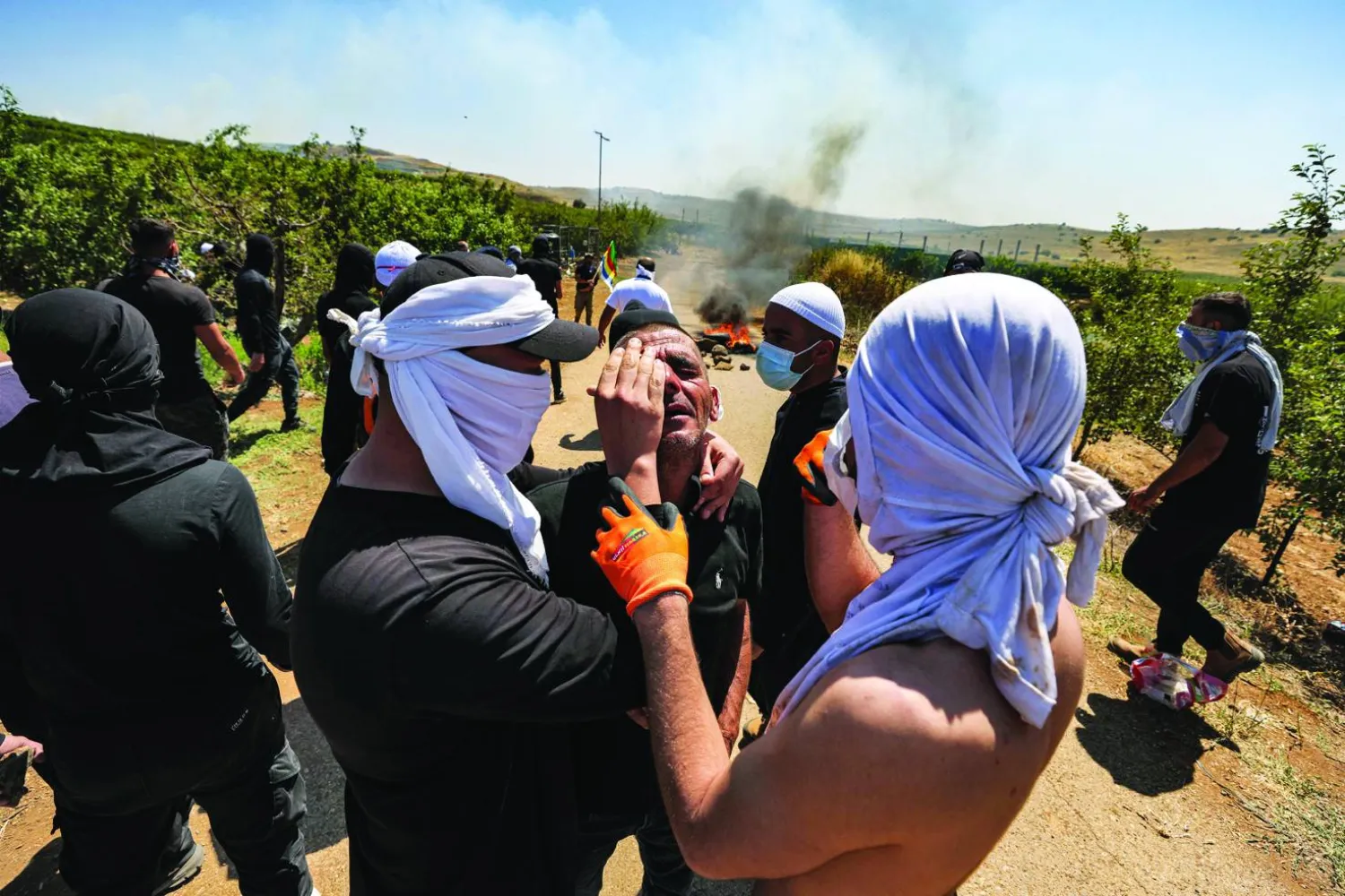 يساعدون متظاهراً أُصيب في قريتهم مجدل شمس بمرتفعات الجولان التي ضمتها إسرائيل عام 1967 (أ.ف.ب)