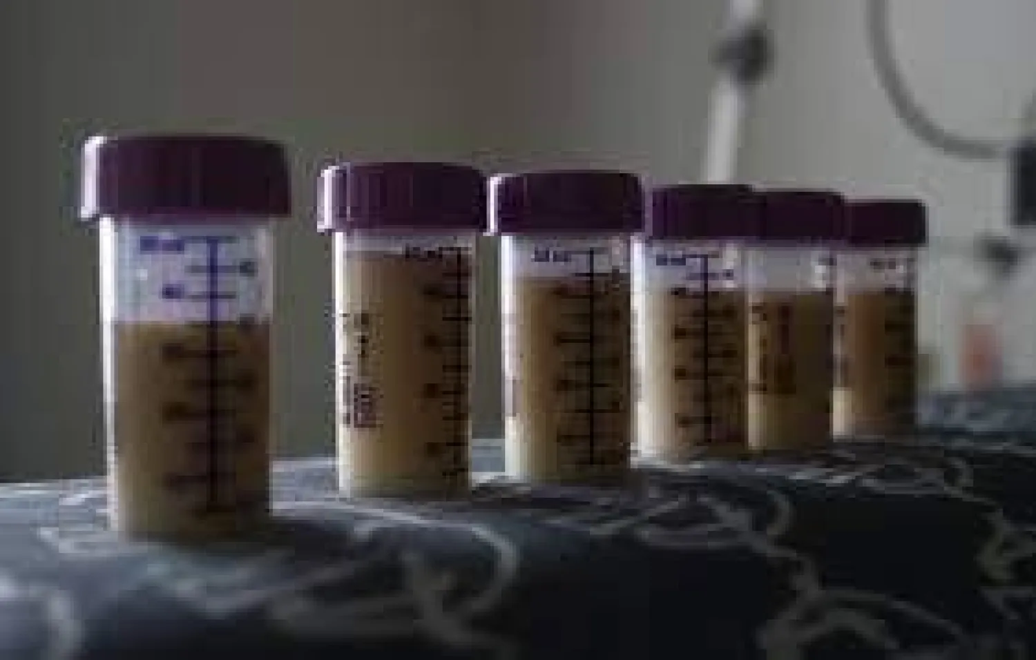 إلى ماذا يشير خروج الدم مع الإدرار؟