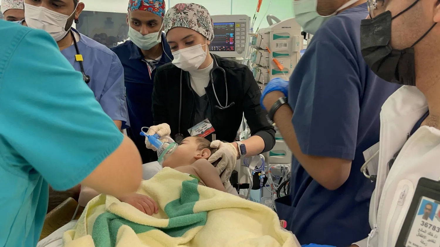 يشترك التوأمان بالأمعاء والكبد (الشرق الأوسط)