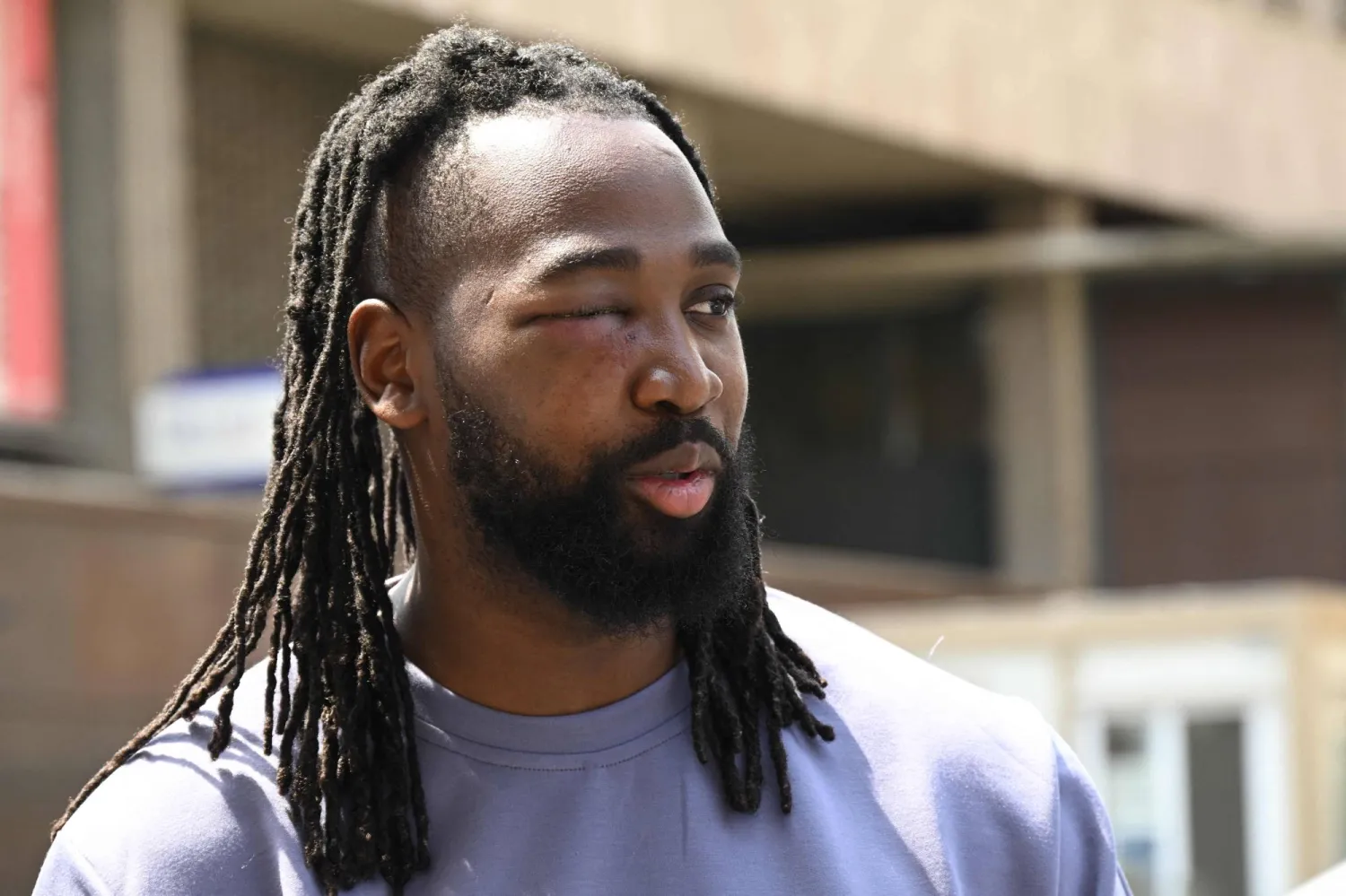 يوسف تراوري بعد خروجه من المستشفى في باريس اليوم (أ.ف.ب)