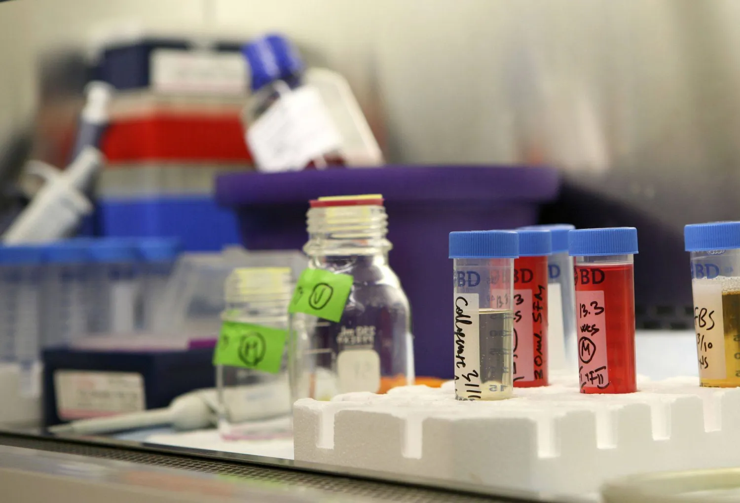 تقرير: لماذا علاجات الخلايا الجذعية باهظة الثمن «وغيرمؤكدة وخطيرة»؟