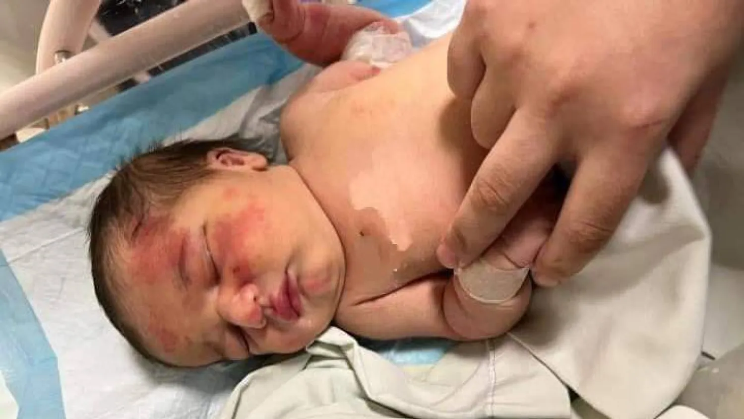 صورة تم تداولها على وسائل إعلام لبنانية للطفلة التي عثر عليها في طرابلس