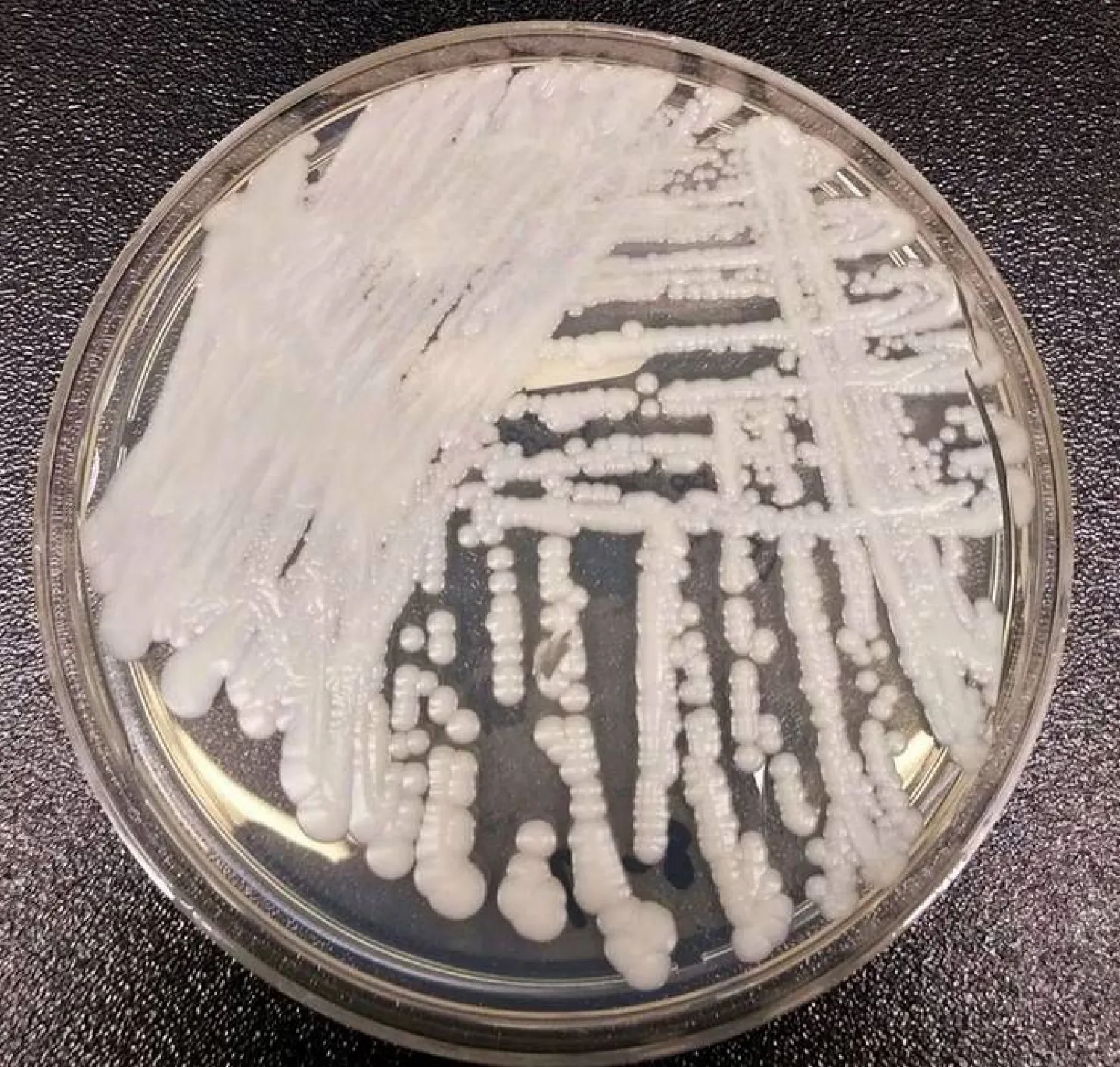 طبيب يكشف الفرق بين العدوى الفطرية البسيطة والخطيرة