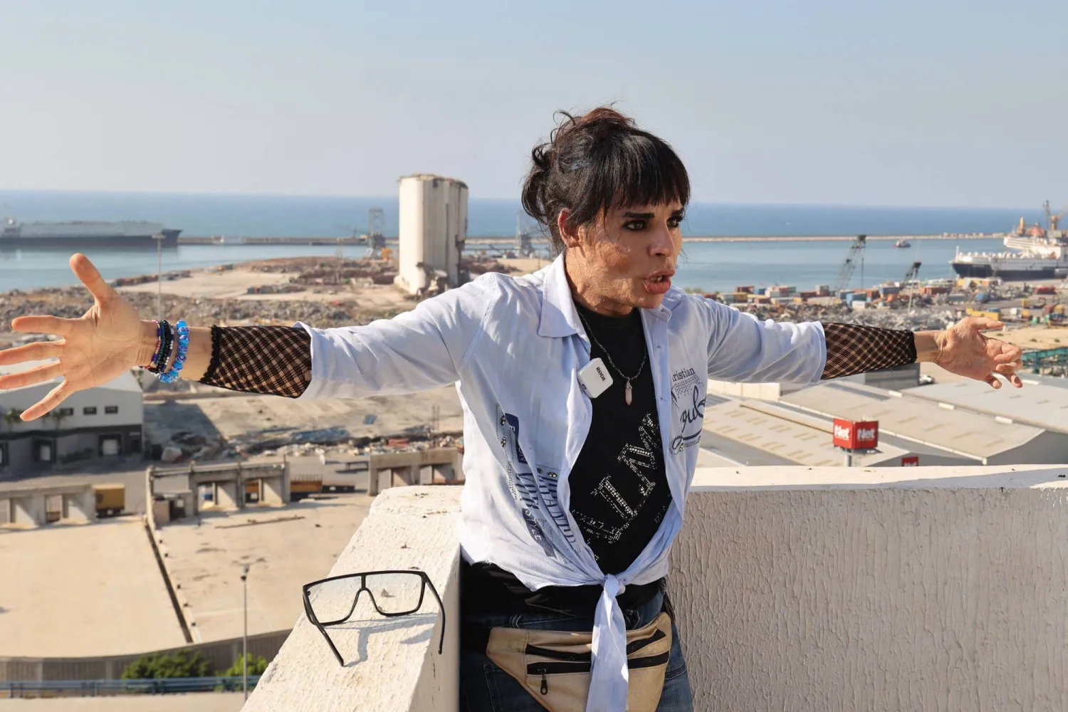 أماندا شري إحدى الناجيات من انفجار مرفأ بيروت وفقدت البصر بإحدى عينيها ولم تعد قادرة على استخدام يدها اليسرى (أ.ف.ب)