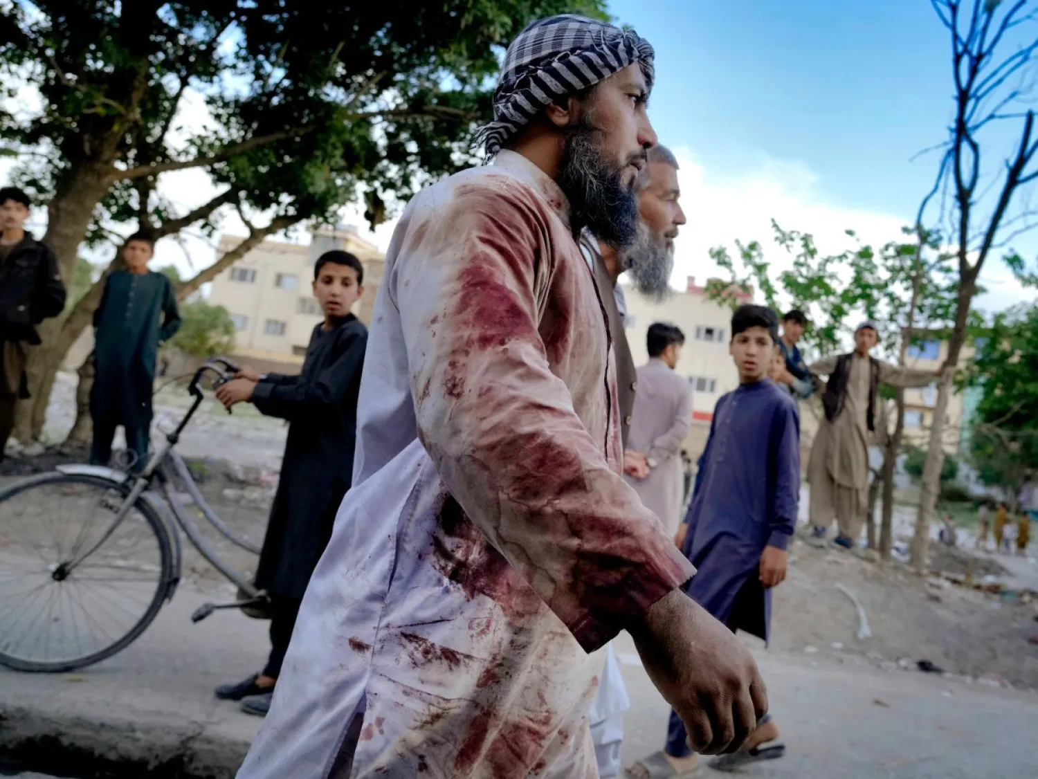 أفغاني ملابسه مخضبة بالدماء في أعقاب انفجار استهدف مسجداً في كابل في أبريل الماضي (أ.ب)