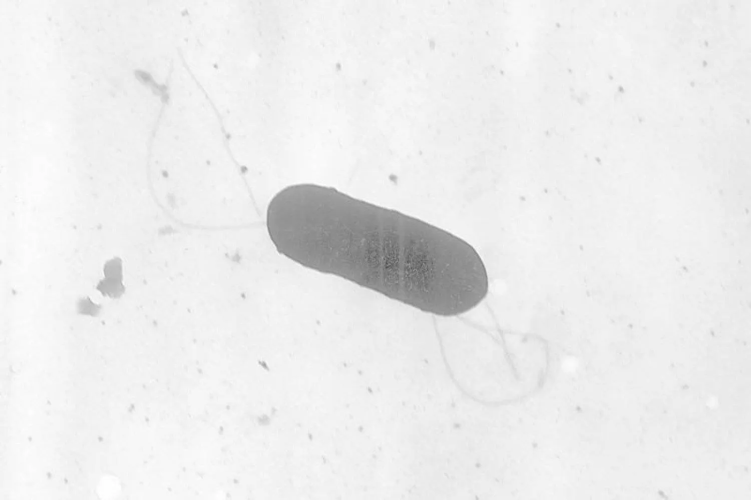 صورة مجهرية لبكتيريا الليستيريا (أ.ب)