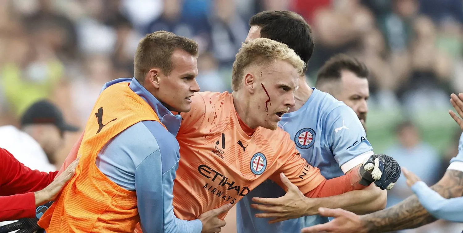 حارس ملبورن سيتي أُصيب بارتجاج في المخ (غيتي)