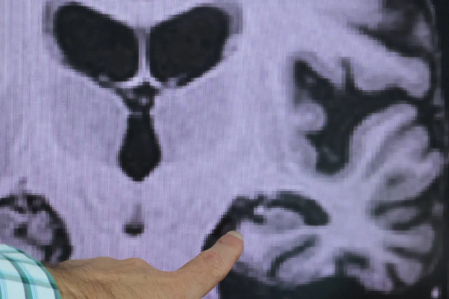 علماء: الخلايا التائية تفقد الذاكرة في ظروف انعدام الوزن !