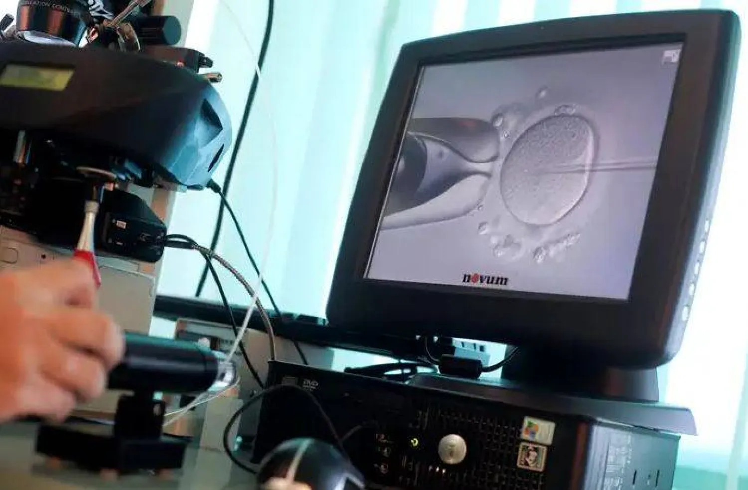 علاجات العقم لدى النساء يمكن أن تحدث تغييرات فسيولوجية (رويترز)