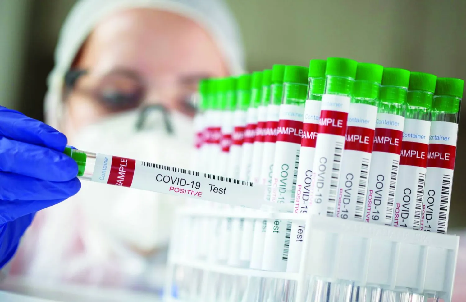 
المتحور «بيرولا» ظهر في بلدان متفرقة حول العالم (Public Domain)