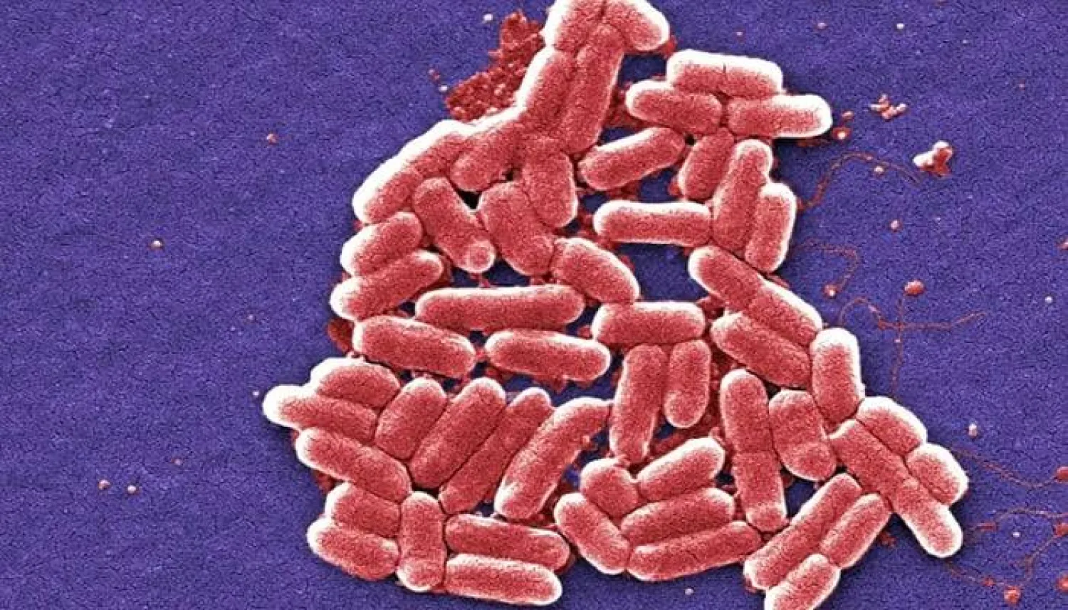 تحذير من بكتيريا آكلة للّحوم في الساحل الشرقي للولايات المتحدة