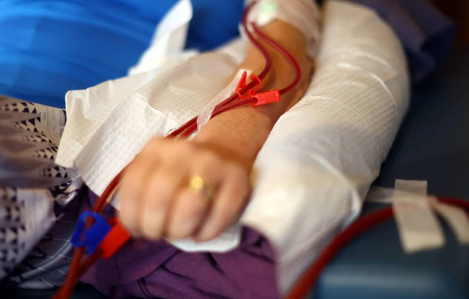 كلية اصطناعية جديدة قد تغيّر مستقبل عمليات الزرع؟!