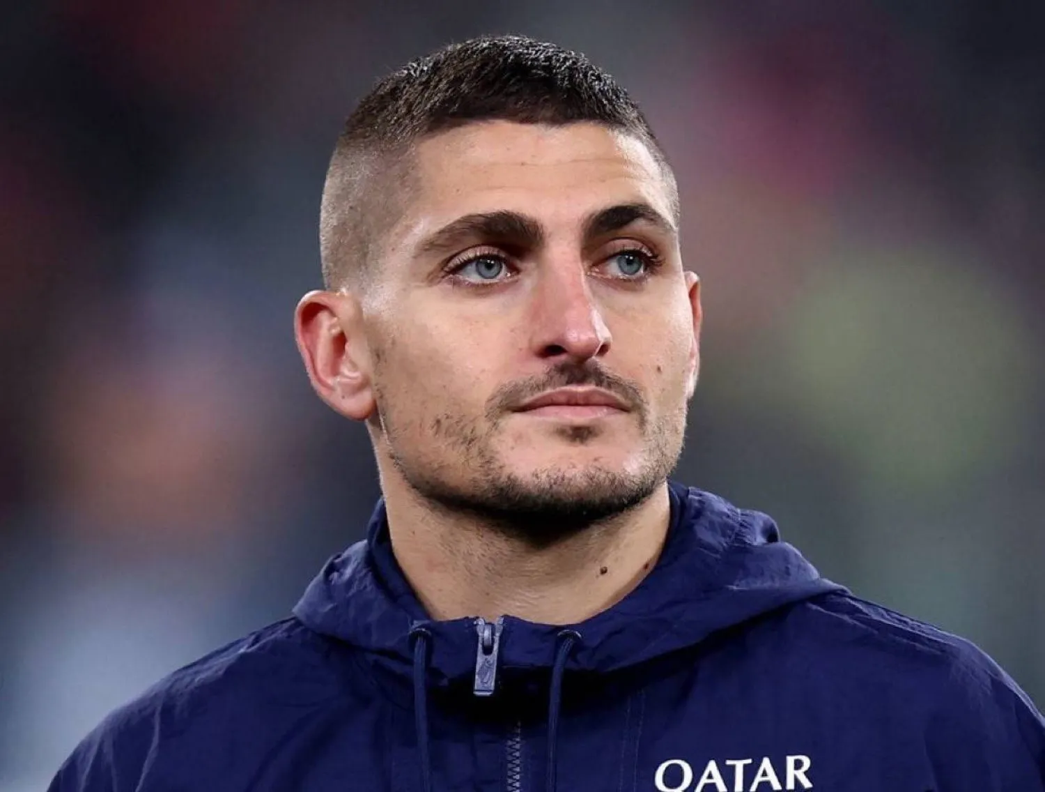 فيراتي (إكس)