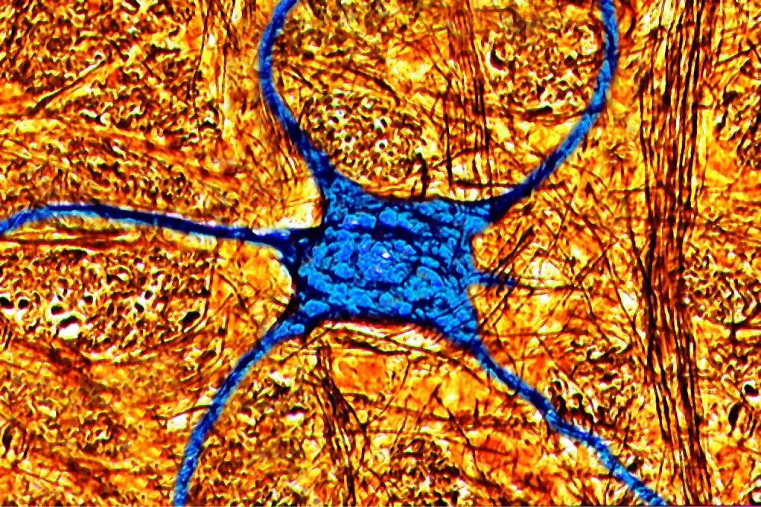 A neuron imaged under a microscope. (BSIP/UIG/Getty Images)