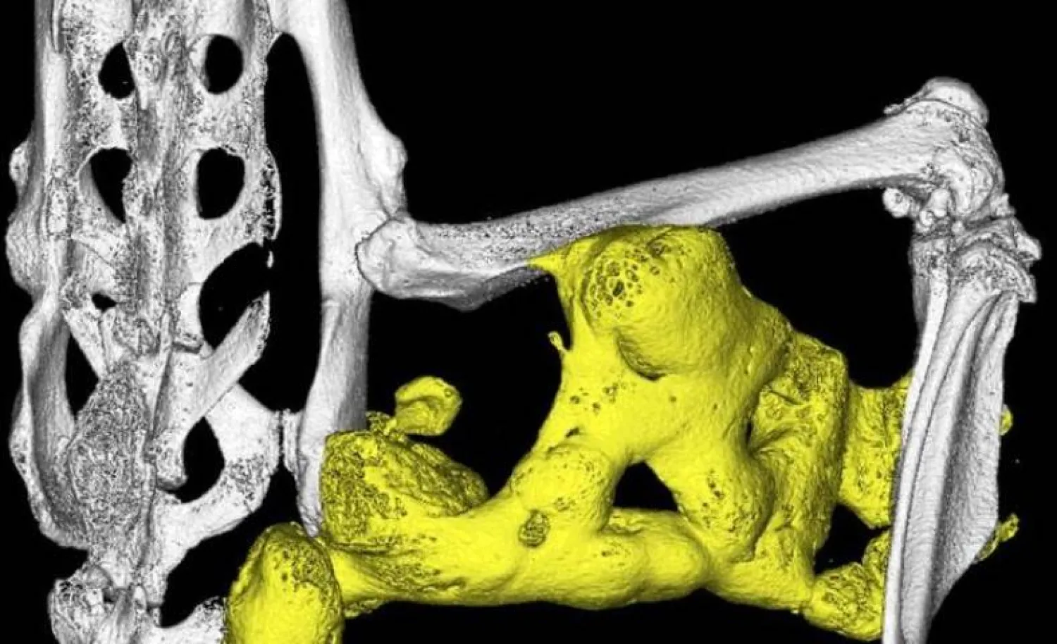 ابتكار سقالات بيولوجية ثلاثية الأبعاد قابلة للتحلل لتجديد العظام