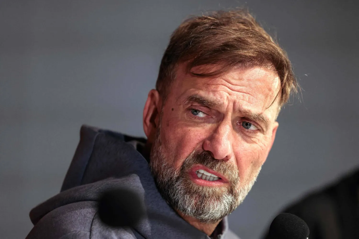 كلوب اعترف بقوة مانشستر سيتي (أ.ف.ب)