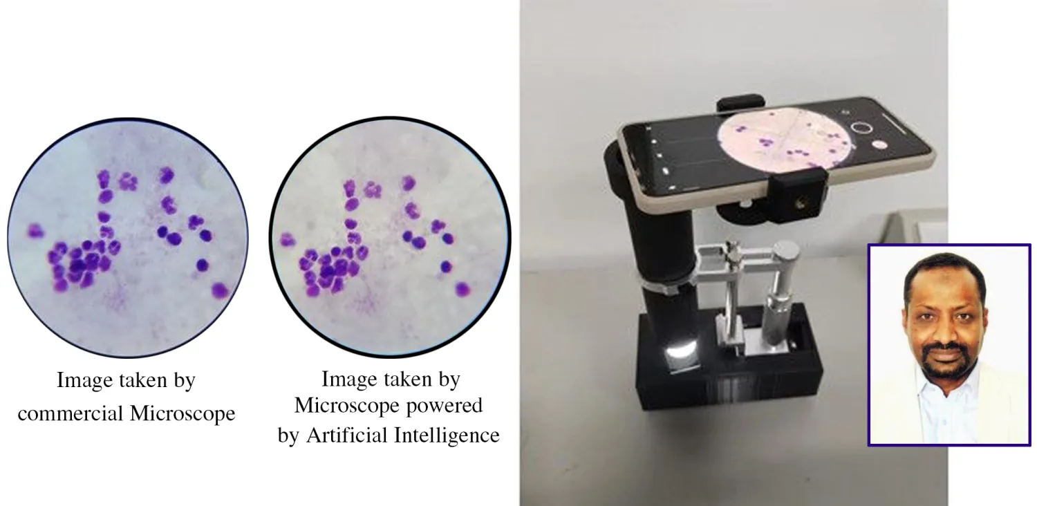 Professor Seedahmed Sharif Mahmoud - AI-Powered Microscope: A Milestone in Global Healthcare (Asharqalawsat)