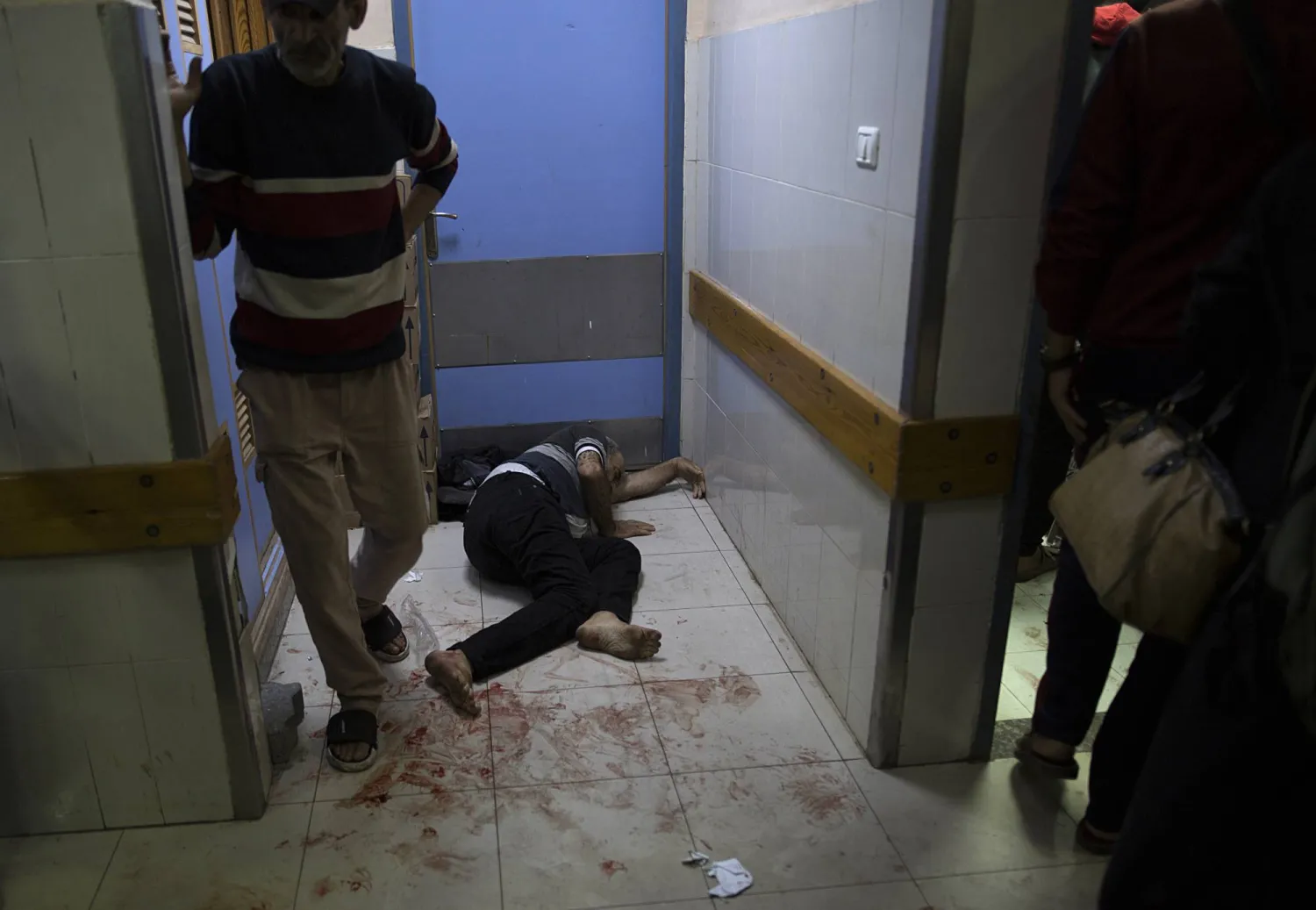  A wounded person lies on the floor at Nasser Hospital in Khan Yunis, southern Gaza Strip, 03 December 2023, following an Israeli air strike. EPA/HAITHAM IMAD
