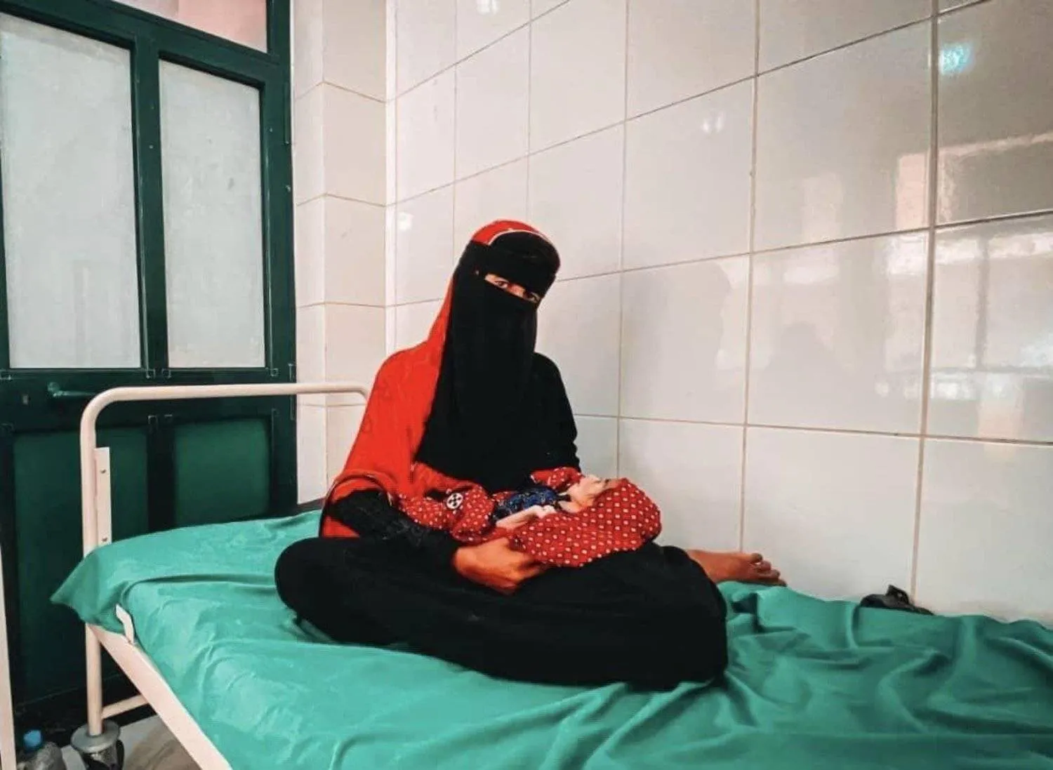 66,000 Yemeni women suffer from malnutrition (UN)