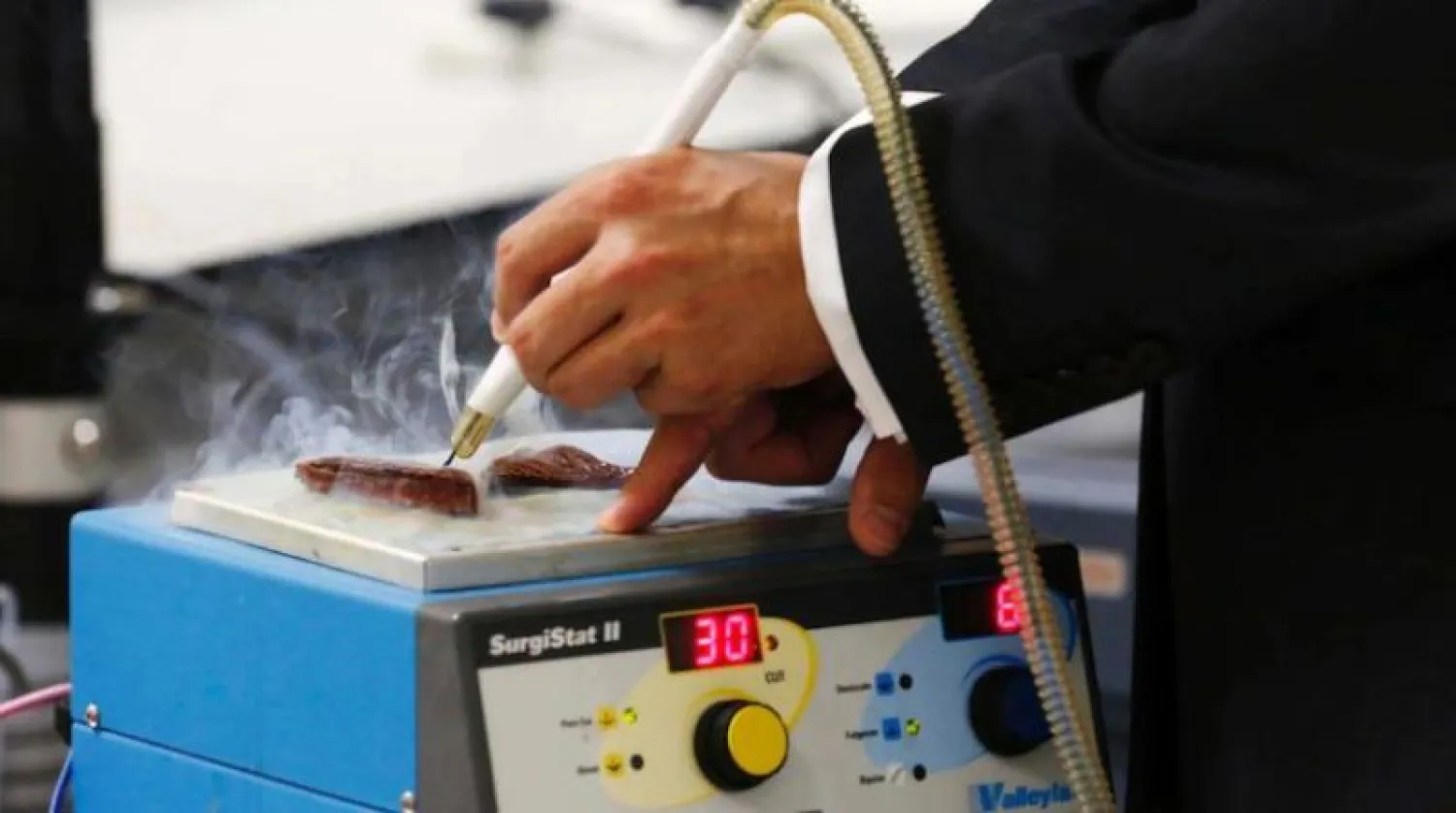 يميز المشرط بين الأنسجة السرطانية والصحية من خلال تحليل الدخان المنبعث عند تبخير نسيج الخزعة (رويترز)