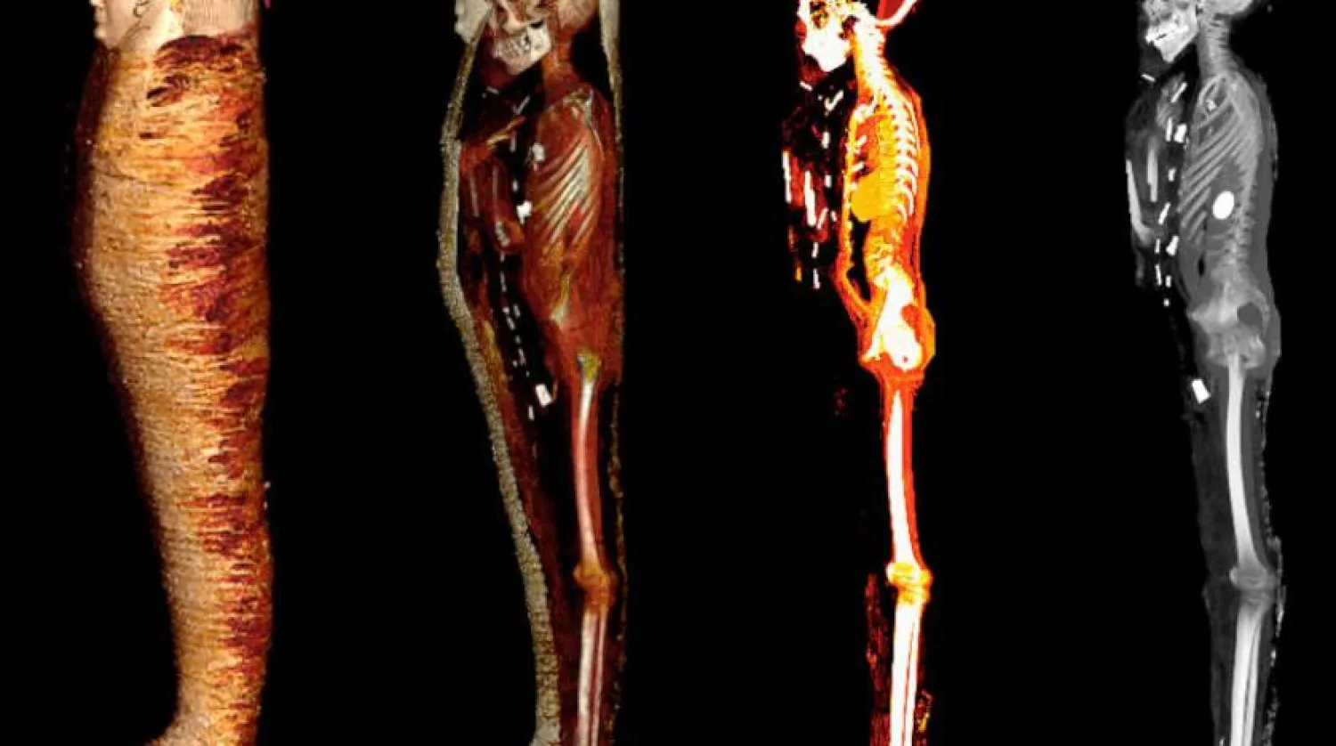 Mumya dijital olarak 4 aşamada çözümleniyor