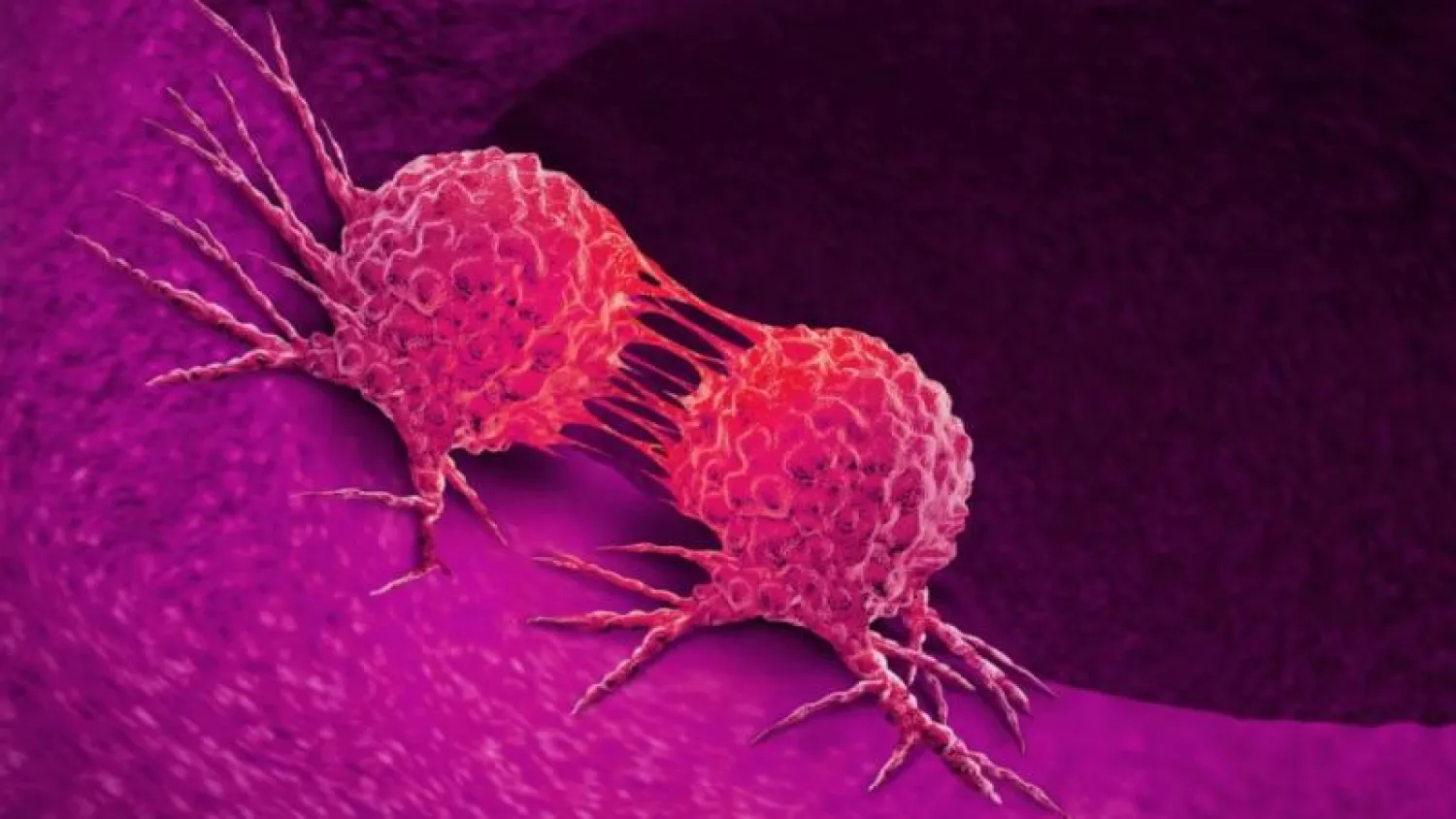 في يومه العالمي... طبيب يشرح حقيقة السرطان