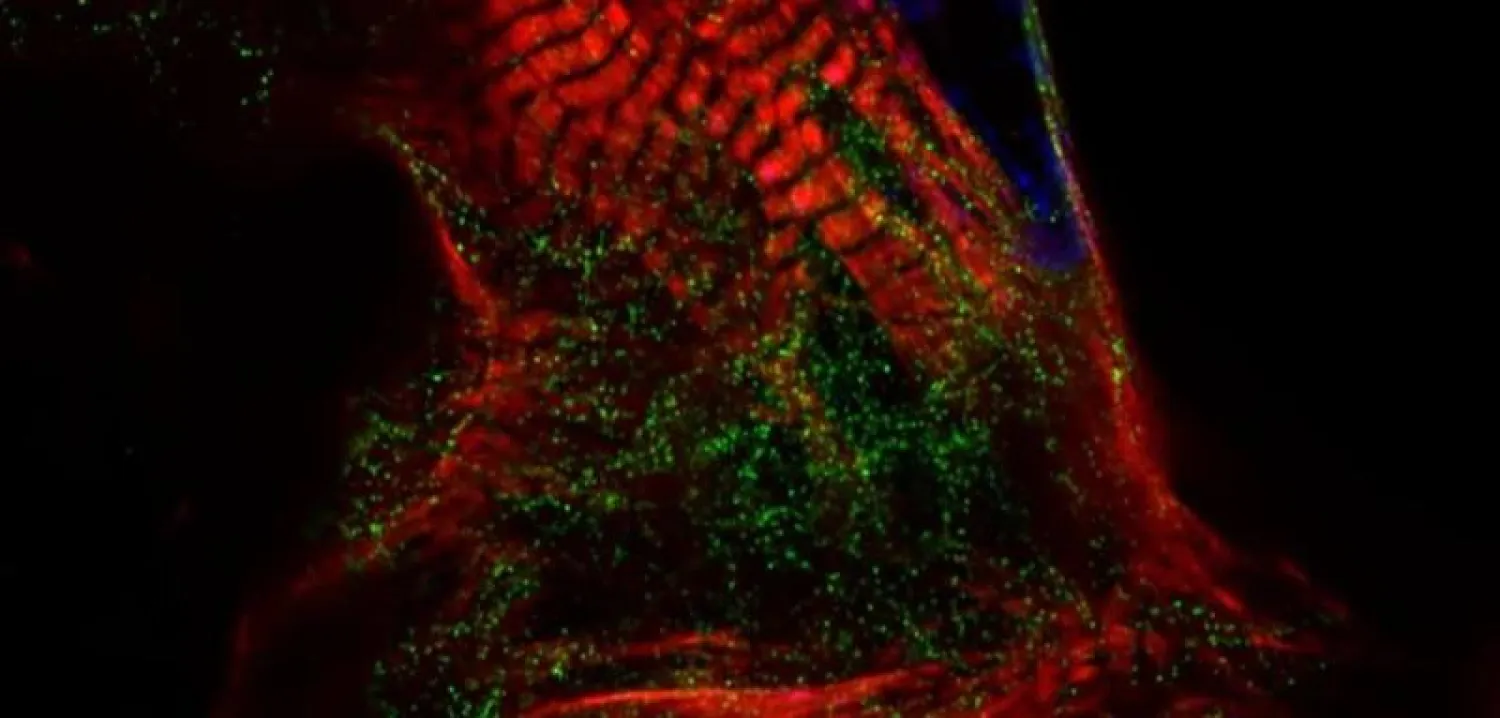 مستقبلات هرمون التوتر باللون الأخضر، في خلايا القلب (الفريق البحثي)