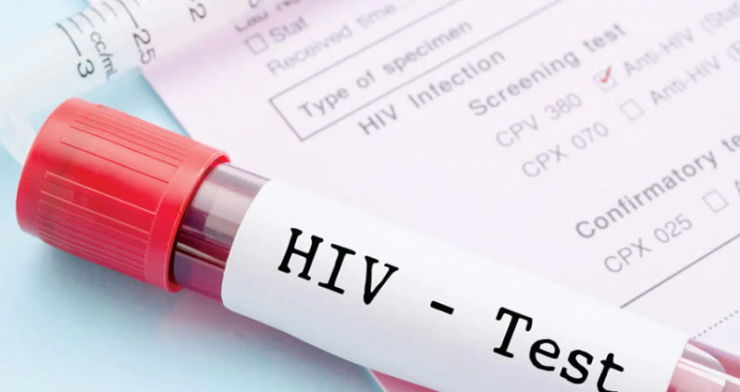 عينة دم لفحص الإصابة بفيروس نقص المناعة (شاترستوك)